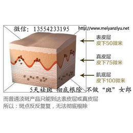 五天祛斑招商加盟,合肥五天祛斑,加盟祛斑