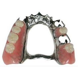 金属假牙义齿激光焊接加工