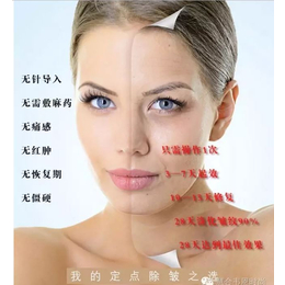 精美****(在线咨询)|上海涂抹v脸|涂抹v脸出水霜  代理
