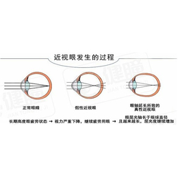 健瞳公司、淮南视力训练、健童视力训练仪