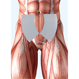 江苏泽康(图)_盆底肌电刺激电片厂商_舟山盆底肌电刺激电片