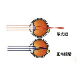 吐鲁番视力矫正_健瞳公司(图)_远视视力矫正仪