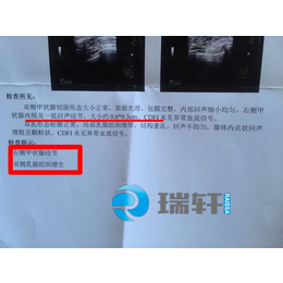 自然莎乳贴对乳腺增生结节效果好安全无副作用