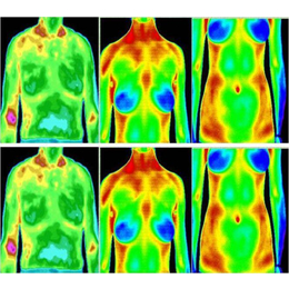 TC-8医用热成像测*