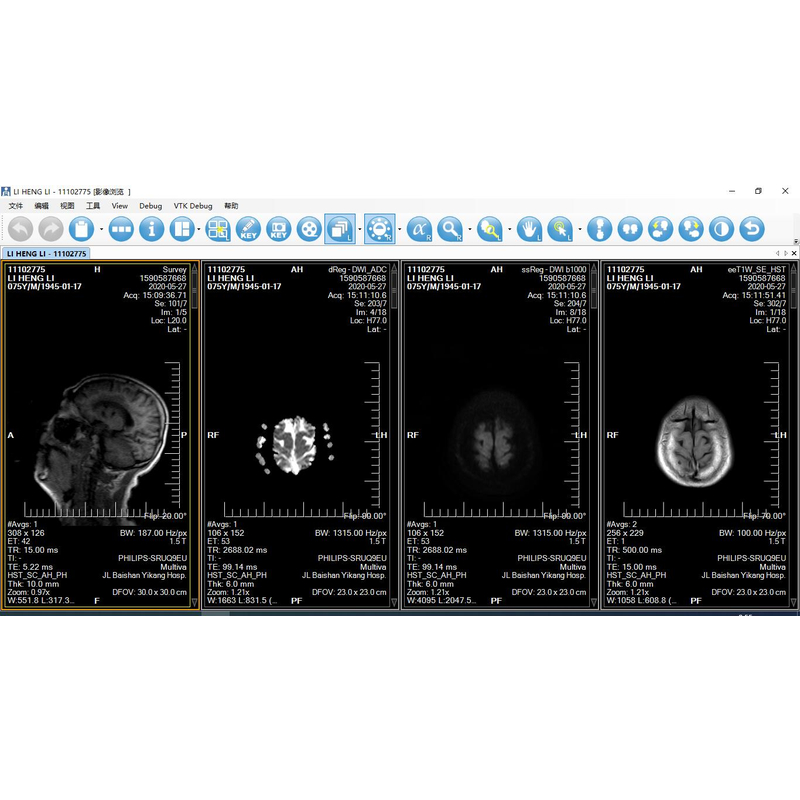 供应索源PACS系统医学影像系统缩略图