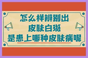 不健康环境以及自身的原因致使白斑大幅度提升