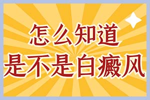 通过白癜风的治疗时长可以确定白癜风是否好治疗吗