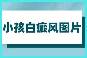 看青少年白癜风郑州西京董思思出马，一个顶两