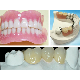  香港制造烤瓷牙 全瓷牙 钢牙托 活动义齿 固定义齿