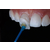 生产加工活动义齿 固定义齿假牙加工烤瓷牙二氧化锆烤瓷牙缩略图3