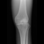 夸特QUART X射线膝盖模体缩略图2