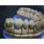 生产加工活动义齿 固定义齿假牙加工烤瓷牙二氧化锆烤瓷牙缩略图4