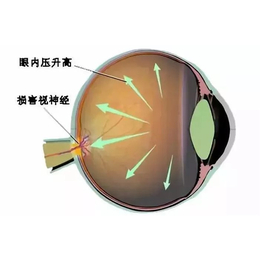 眼睛增视仪-增视仪-戴明视